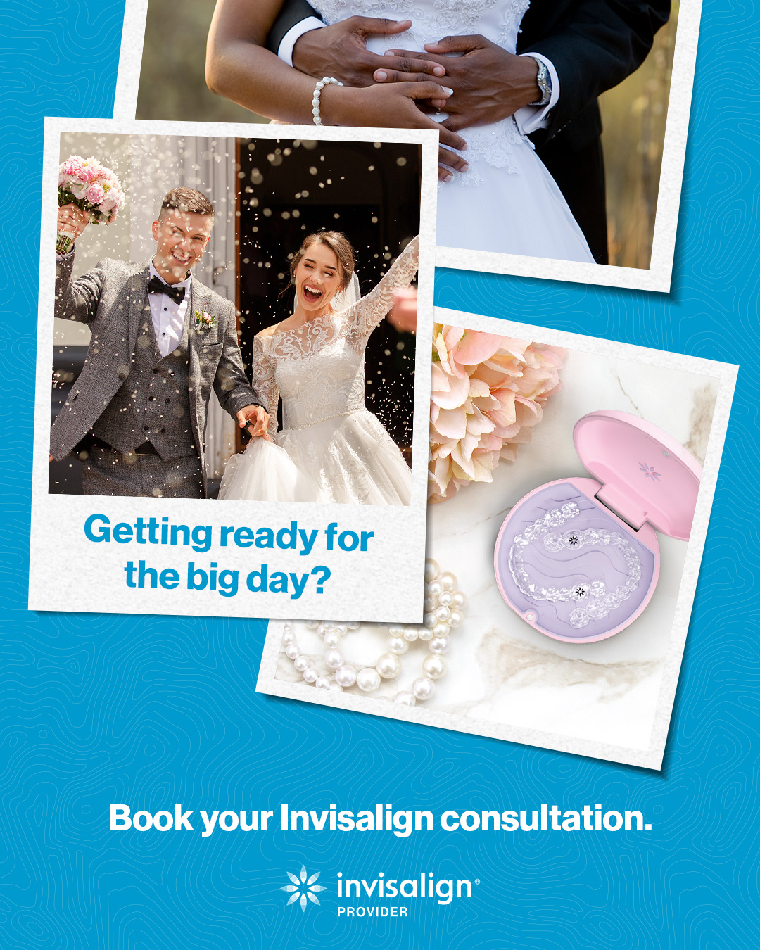 What is Invisalign? 2 svg+xml;charset=utf